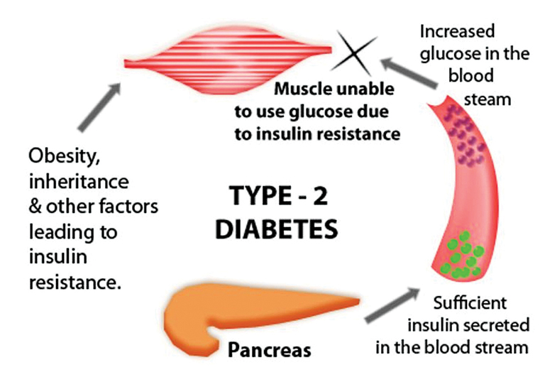 non insulin dependent diabetes